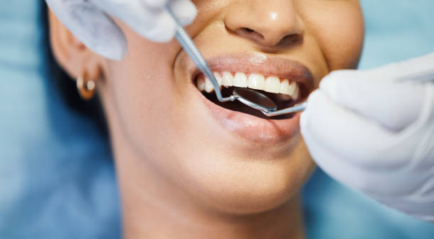 Best Emergency Dentist for Lost Fillings or Crowns in Parsons, KS